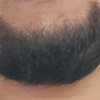 btofdrc