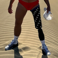 amputeeboy