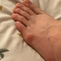 feettravelling