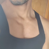 forresttwink